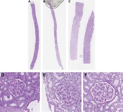 Machine learning in renal pathology